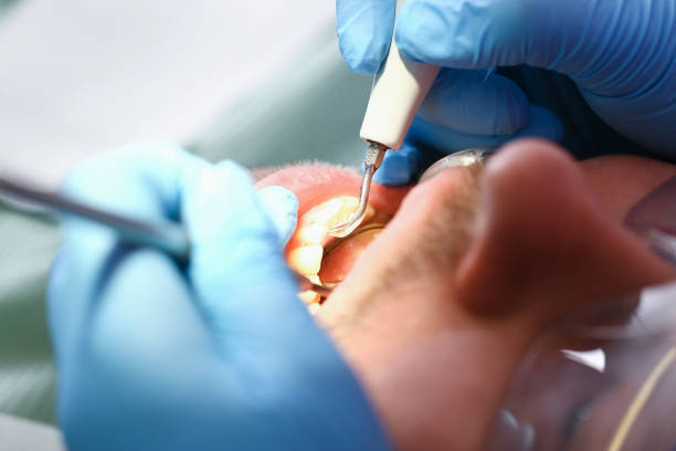 Best Emergency Dental Care for Broken or Chipped Teeth in Mcalester, OK