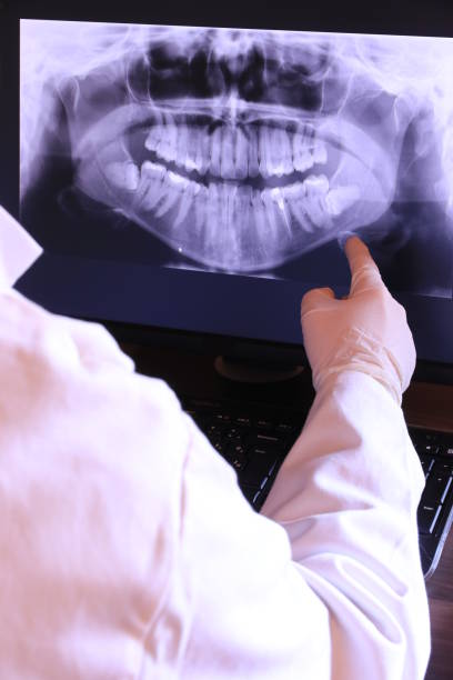 Best Emergency Root Canal Treatment in Mcalester, OK