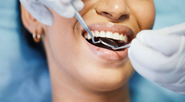 Best Emergency Tooth Extraction in Mcalester, OK