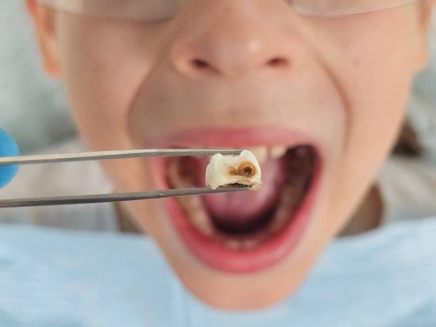 Best Emergency Orthodontic Services in Mcalester, OK